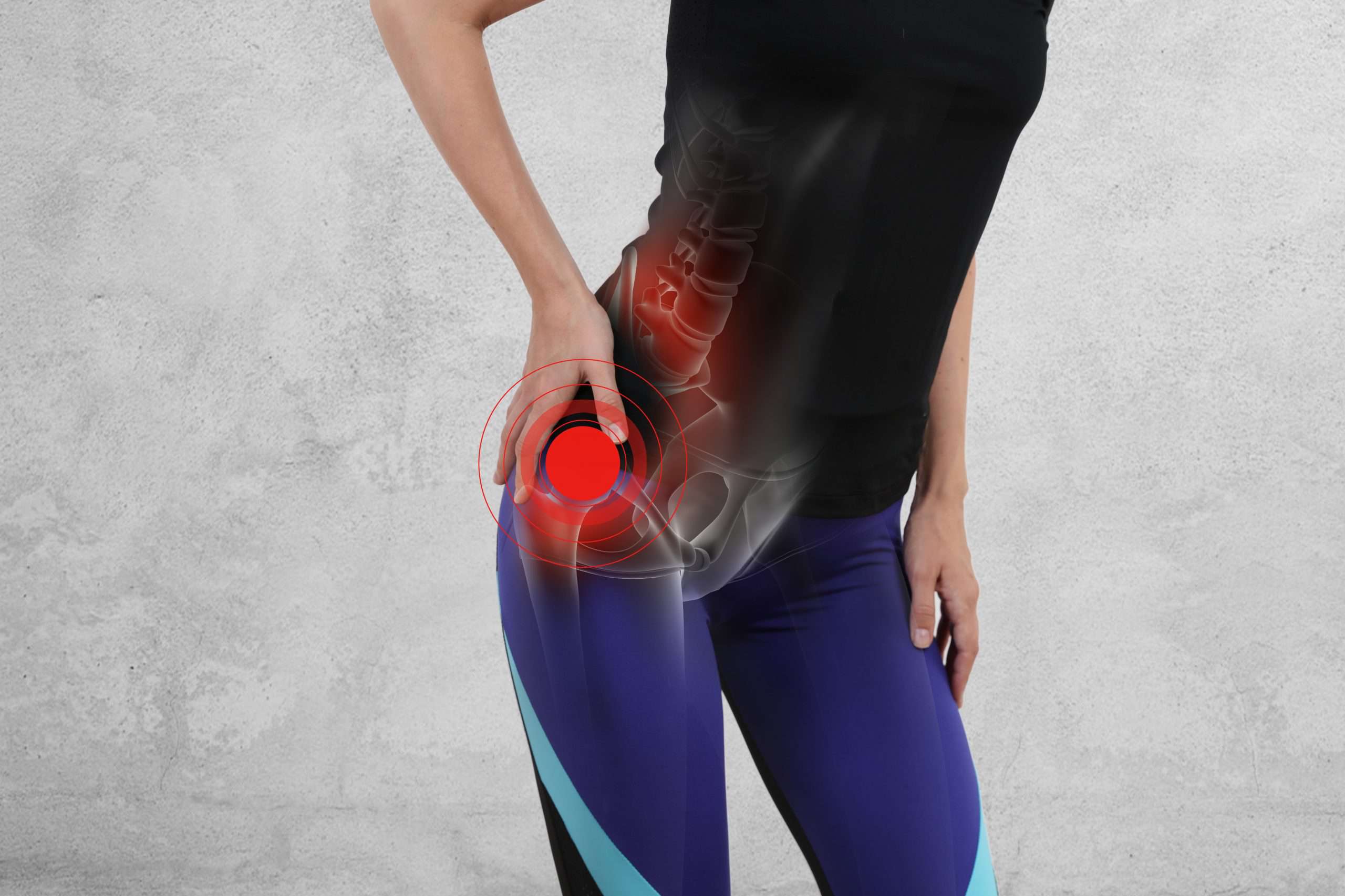 Total Hip Replacement FAQ - Scottsdale Joint Center