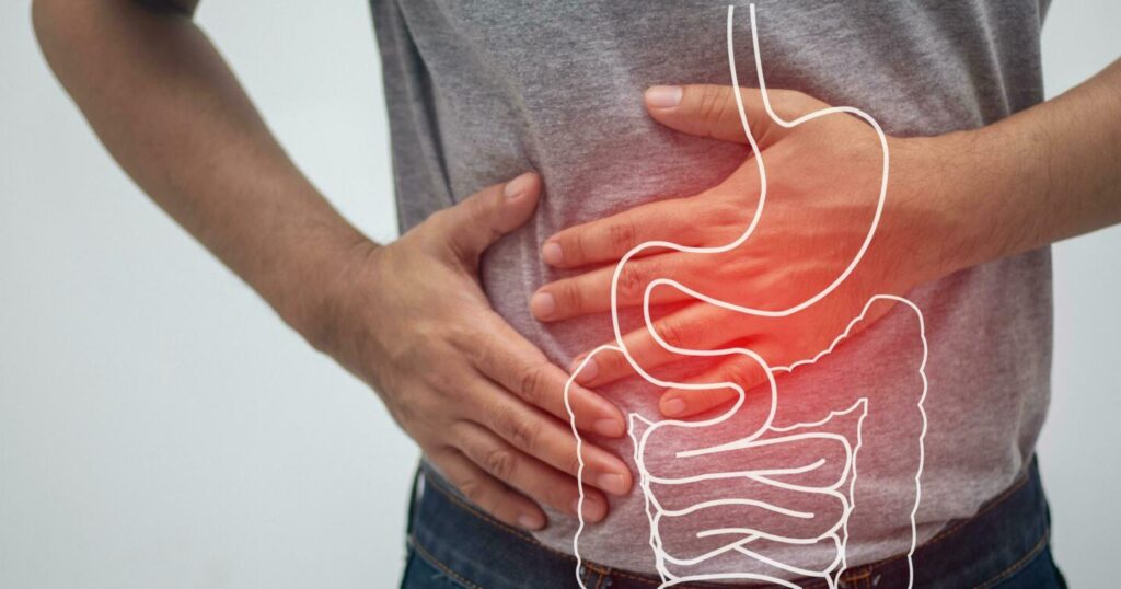 Crohn's disease is a chronic condition that affects the digestive tract, causing inflammation, abdominal pain, and other symptoms.